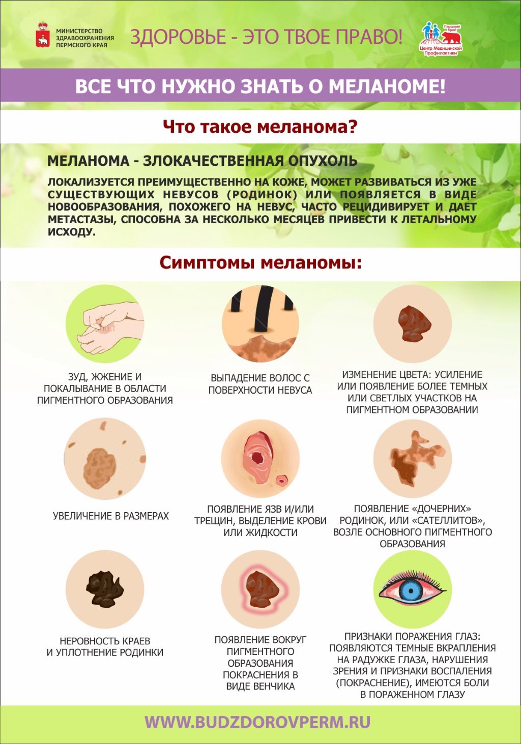Меланома